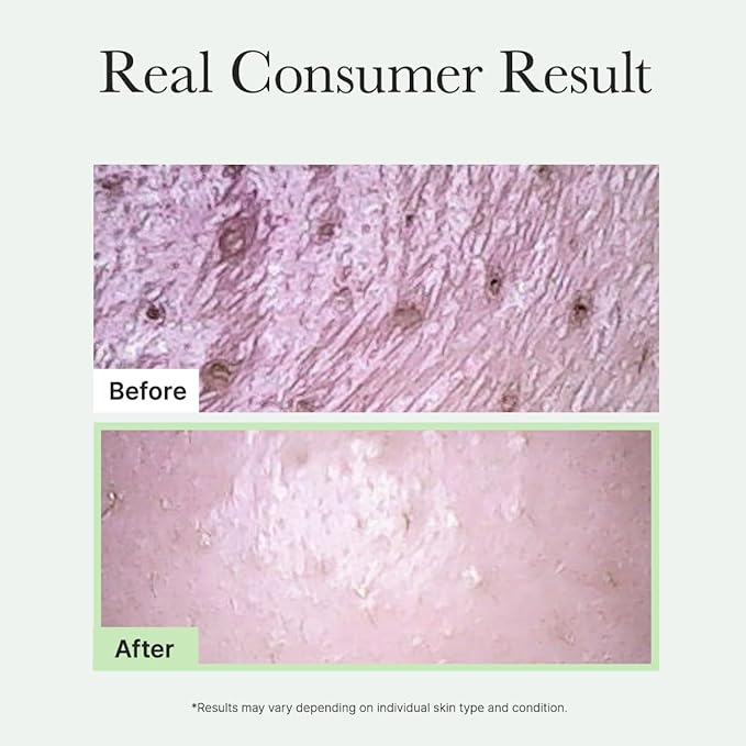Arencia Korean Rice Mochi Face Cleanser & Daily Scrub - Moisturizing, Brightening & Deep-Cleansing - All Skin Types, Vegan, Organic - with Rice Powder, Rice Water & Green Tea (1.76oz)