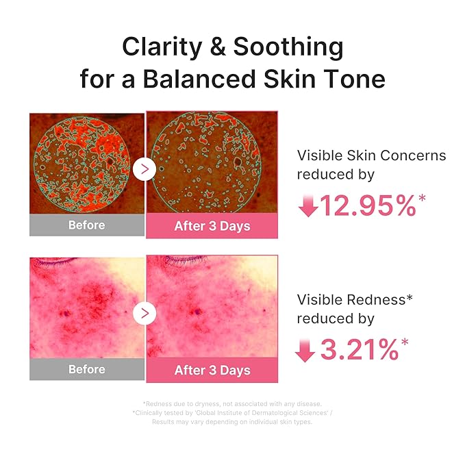medicube PDRN Pink Peptide Serum with Salmon DNA | Ultra Light Hydrating Serum with Hyaluronic Acid | Fast-Absorbing Glow Care for Skin Clarity | Korean Skincare, 1.01 fl. Oz