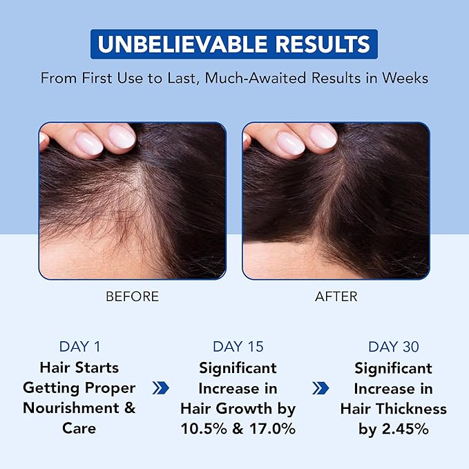 Botanic Hearth Hair Oil for Hair Growth | Rosemary Oil for Hair Growth with Biotin, Castor & Jojoba | Scalp Oil & Dry Scalp Treatment | Color Safe | All Hair Types | 6.7 Fl Oz