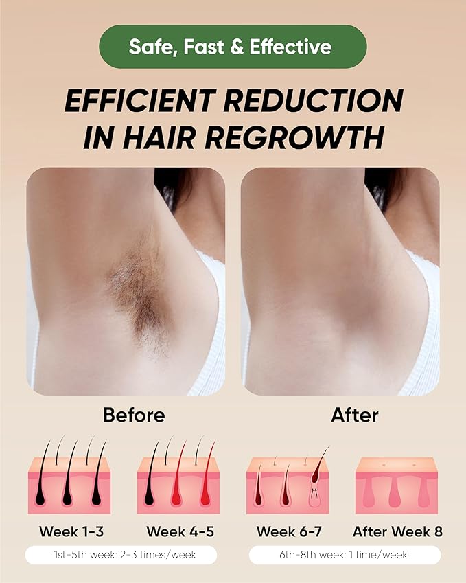 XSOUL At-Home IPL Hair Removal for Women and Men Permanent Hair Removal 999,999 Flashes Painless Hair Remover on Armpits Back Legs Arms Face Bikini Line, Corded