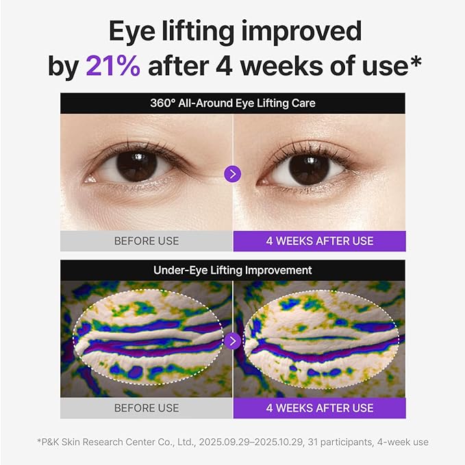 Centellian24 360 Shot PDRN Firming Eye Cream 30ml (1.01 fl oz) – Anti-Aging Retinol Eye Cream for Hooded Eyes, Wrinkle Smoothing, Firming Hydrating Care for Under-Eye Bags, Crow’s Feet & Dark Circles