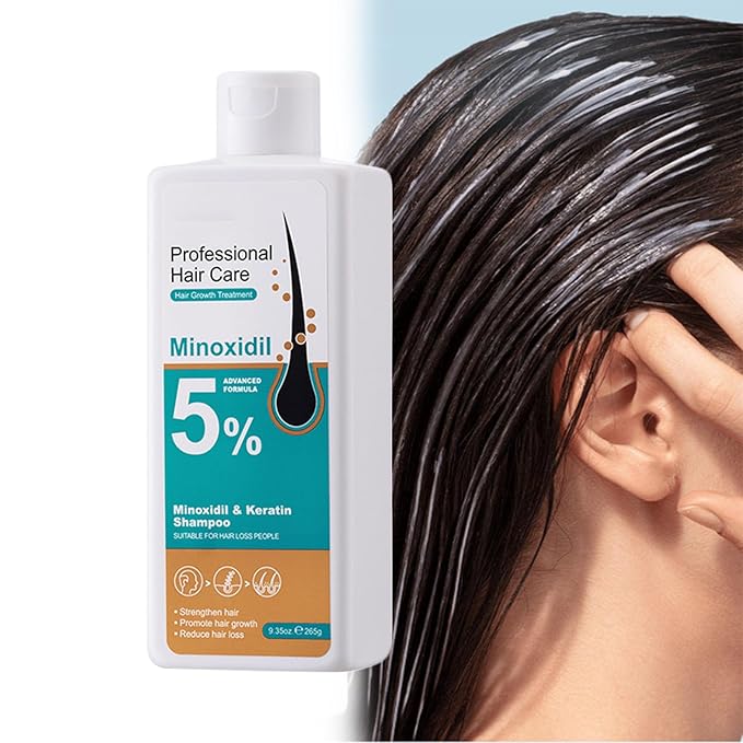 コルムシック 5% ミノキシジル 育毛頭皮マッサージクリーム、プロフェッショナルヘアケアミノキシジル、男女兼用ローズマリービオチン配合育毛剤、素早い再成長と髪の根の強化 (1個)