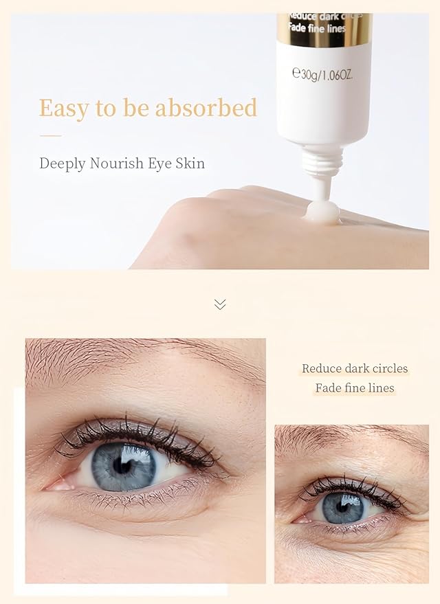Dark Circles & Puffiness Eye Cream - Snail Mucin & Red Ginseng Formula for Under Eye Bags, Fine Lines, Intense Moisturizing & Brightening Korean Eye Treatment, 30g