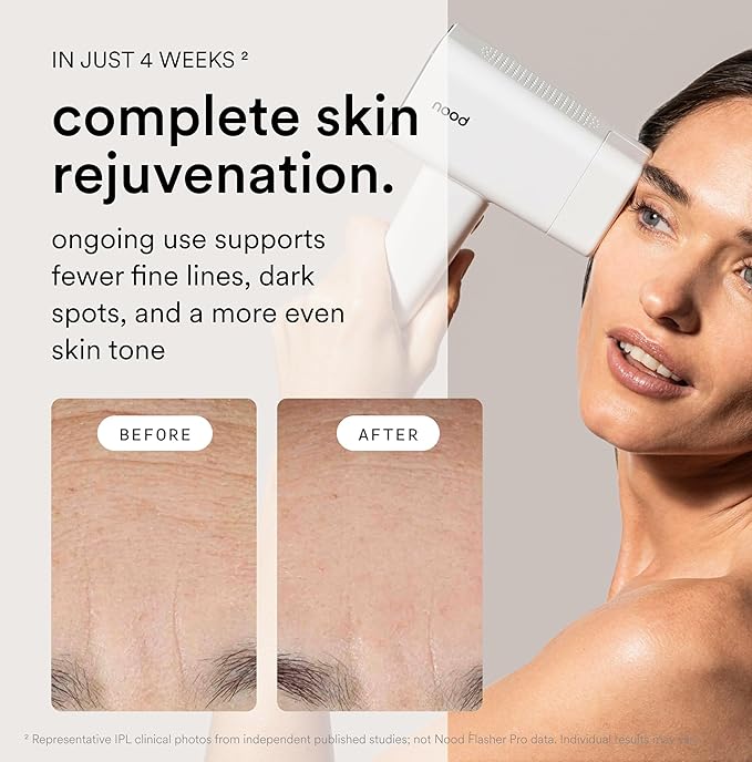Nood™ NEW Flasher Pro — IPL Laser Hair Removal Device & Anti-Aging Red Light Therapy for Women & Men — Pain-free, Permanent, Visible Results After First Use & Works Everywhere Hair Grows — Gloss White
