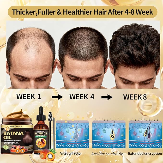 Batana Oil for Hair Growth–4Pc Set: Raw Batana Oil,Hair Mask Paste,Lash Wand & Brow Brush,Hair Growth Treatment Promotes Hair Thickness,Prevents Loss for Men Women,Deep Care for Scalp,Edges & Eyebrows
