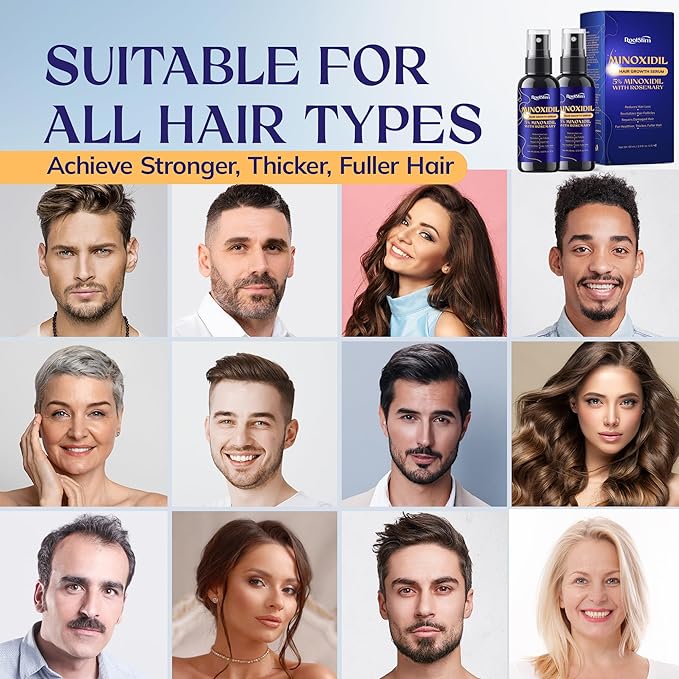 5% Minoxidil Kit for Men and Women – 6-Pack Beard Growth Kit & Hair Regrowth Spray – Targets Thinning Hairlines, Crowns & Patchy Beards – 360 mL