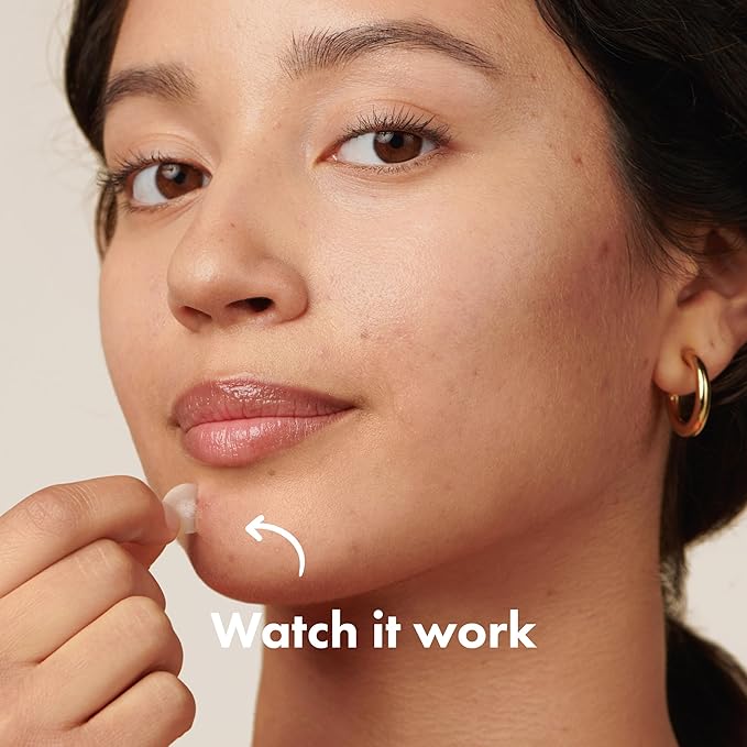 Mighty Patch Original Patch from Hero Cosmetics - #1 Hydrocolloid Acne Pimple Patches for Face, Shrinking Zits & Whiteheads in 1 Use, Nighttime Spot Pimple Stickers for Face, 75 Count